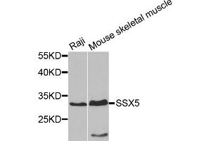 Western blot analysis of extracts of various cell lines, using SSX5 antibody. (SSX5 Antikörper)