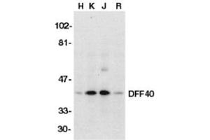 Western blot analysis of DFF40 in HeLa (H), K562 (K), Jurkat (J), and Raji (R) whole cell lysate with AP30286PU-N DFF40 antibody (I18) at 1/500 dilution. (DFFB Antikörper)