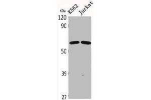 Western Blot analysis of K562 Jurkat cells using CDYL2 Polyclonal Antibody (CDYL2 Antikörper  (N-Term))
