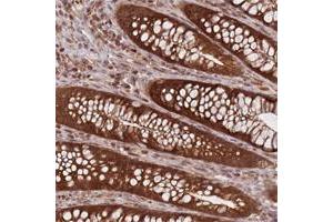 Immunohistochemical staining of human stomach with CXorf57 polyclonal antibody  shows strong nuclear, cytoplasmic and membranous positivity in glandular cells. (CXORF57 Antikörper)