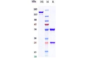 Anti-GUCY2C Reference Antibody (indusatumab) on SDS-PAGE under reducing (R) condition. (Rekombinanter GUCY2C (Indusatumab Biosimilar) Antikörper)