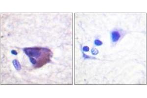 Immunohistochemistry (IHC) image for anti-Potassium Voltage-Gated Channel, Shab-Related Subfamily, Member 1 (KCNB1) (AA 533-582), (pSer567) antibody (ABIN1531683)