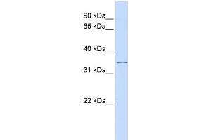 WB Suggested Anti-KCNRG Antibody Titration:  0. (KCNRG Antikörper  (Middle Region))