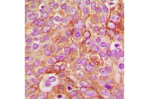 Immunohistochemistry (IHC) image for anti-gamma-aminobutyric Acid (GABA) A Receptor, Subunit beta 1 (GABRB1) (C-Term), (pSer434) antibody (ABIN7300716)