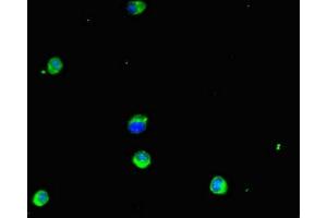 Immunofluorescent analysis of Hela cells using ABIN7154103 at dilution of 1:100 and Alexa Fluor 488-congugated AffiniPure Goat Anti-Rabbit IgG(H+L) (GSTM1 Antikörper  (AA 24-156))