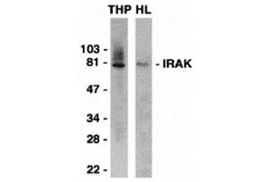 Western Blotting (WB) image for anti-Interleukin-1 Receptor-Associated Kinase 1 (IRAK1) (C-Term) antibody (ABIN1030443) (IRAK1 Antikörper  (C-Term))