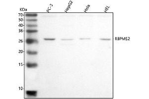 Western blot analysis of RBPMS2 using anti-RBPMS2 antibody (ABIN7599770).
