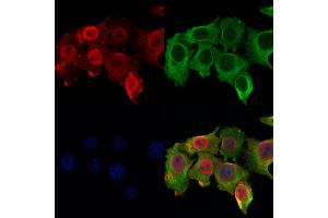 ABIN6264810 and ABIN6278517 staining Hela cells by IF/ICC. (RPA4 Antikörper  (Internal Region))