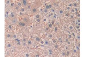 DAB staining on IHC-P; Samples: Human Liver Tissue (desert Hedgehog Antikörper  (AA 241-383))
