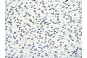 Rabbit Anti-KHDRBS1 antibody Catalog Number: ARP40665  Paraffin Embedded Tissue: Human Heart cell Cellular Data: cardiac cell of renal tubule Antibody Concentration: 4.