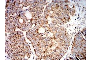 Immunohistochemistry (IHC) image for anti-Superoxide Dismutase 2, Mitochondrial (SOD2) (AA 1-222) antibody (ABIN5542468)