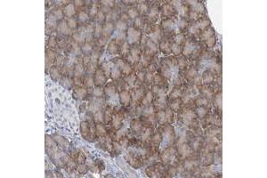 Immunohistochemical staining of human pancreas with LCA5 polyclonal antibody  shows moderate cytoplasmic positivity in exocrine glandular cells.