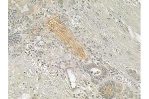 ABIN6257012 and ABIN6274964 at 1/100 staining human normal liver tissue by IHC-P. (CBR1 Antikörper  (C-Term))