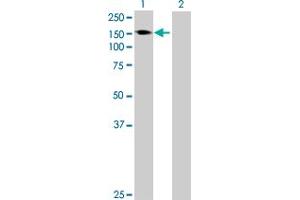 Western Blot analysis of AKAP1 expression in transfected 293T cell line by AKAP1 MaxPab polyclonal antibody. (AKAP1 Antikörper  (AA 1-903))