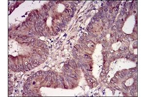 Fig. (CSNK2B Antikörper  (AA 1-215))