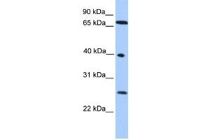 WB Suggested Anti-L3MBTL2 Antibody Titration: 0. (L3MBTL2 Antikörper  (N-Term))