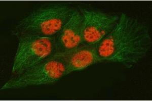 IF analysis of SNRPA1 and Tubulin beta using anti-SNRPA1 antibody (ABIN7599131) and anti-Tubulin beta antibody (ABIN7602744). (SNRPA1 Antikörper  (AA 1-233))