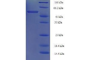 SDS-PAGE (SDS) image for Tu Translation Elongation Factor, Mitochondrial (Tufm) (AA 1-396), (full length) protein (His-SUMO Tag) (ABIN5710566) (TUFM Protein (AA 1-396, full length) (His-SUMO Tag))