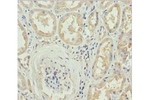Immunohistochemistry of paraffin-embedded human kidney tissue using ABIN7149603 at dilution of 1:100 (DOCK8 Antikörper  (AA 1900-2099))