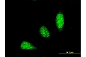 Immunofluorescence of monoclonal antibody to TRIM31 on HeLa cell. (TRIM31 Antikörper  (AA 1-100))