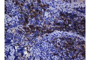 Immunohistochemistry (IHC) image for anti-T-cell surface glycoprotein CD1c (CD1C) antibody (ABIN2670676) (CD1c Antikörper)
