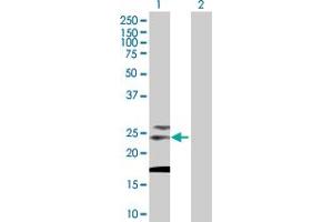 Western Blot analysis of TSPAN31 expression in transfected 293T cell line by TSPAN31 MaxPab polyclonal antibody. (TSPAN31 Antikörper  (AA 1-210))