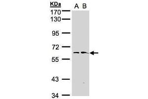 WB Image Sample(30 ug whole cell lysate) A:Hep G2 , B:Raji , 7. (FMO1 Antikörper)