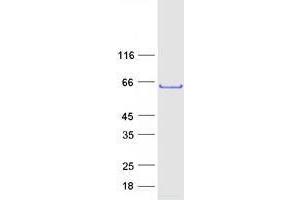 Western Blotting (WB) image for Tubby Like Protein 3 (TULP3) protein (Myc-DYKDDDDK Tag) (ABIN2734601)