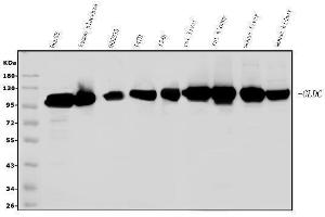 Western blot analysis of Glycine decarboxylase/GLDC using anti-Glycine decarboxylase/GLDC antibody (ABIN7602073).