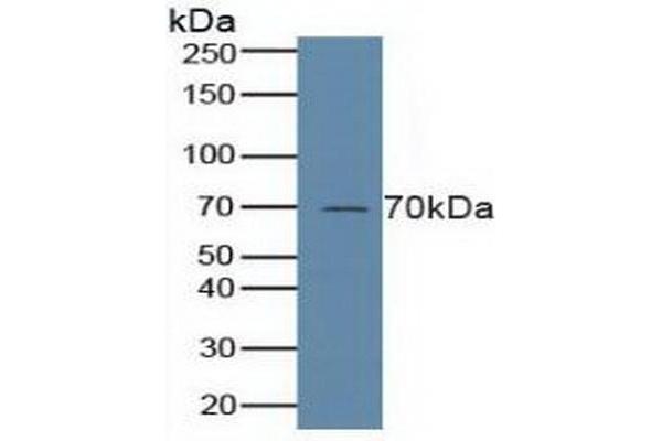 ALOX5 antibody  (AA 461-671)