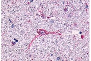 Anti-NTSR1 antibody  ABIN1049154 IHC staining of human brain, neurons and glia. (NTSR1 Antikörper  (N-Term))