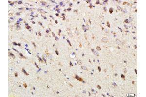Immunohistochemistry (Paraffin-embedded Sections) (IHC (p)) image for anti-DEP Domain Containing mTOR-Interacting Protein (DEPTOR) (AA 56-170) antibody (ABIN1387597)