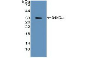 Detection of Recombinant PTPN2, Human using Polyclonal Antibody to Protein Tyrosine Phosphatase, Non Receptor Type 2 (PTPN2) (PTPN2 Antikörper  (AA 1-257))