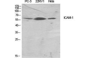 Western Blot (WB) analysis of specific cells using ICAM-1 Polyclonal Antibody. (ICAM1 Antikörper  (Ser518))