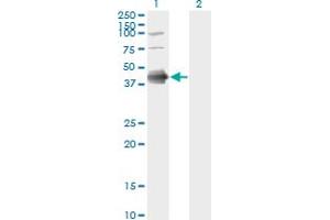 Western Blot analysis of FCER2 expression in transfected 293T cell line by FCER2 monoclonal antibody (M03), clone S52. (FCER2 Antikörper  (AA 1-321))
