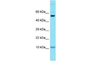 Host: Rabbit Target Name: GCSAML Sample Type: Placenta lysates Antibody Dilution: 1. (GCSAML Antikörper  (N-Term))