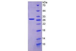 SDS-PAGE analysis of Human FOLR1 Protein. (FOLR1 Protein)