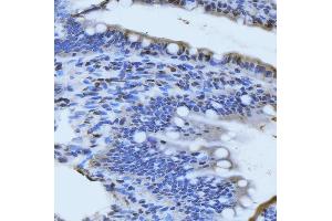 anti-MRE11 Meiotic Recombination 11 Homolog A (S. Cerevisiae) (MRE11A) (AA 14-481) antibody