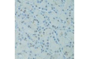 Immunohistochemistry of paraffin-embedded rat pancreas using GTF2H2C antibody (ABIN5973022) at dilution of 1/100 (40x lens). (GTF2H2C Antikörper)