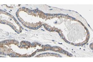 ABIN6269185 at 1/100 staining Human prostate tissue by IHC-P. (TNNI3 Antikörper)