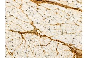 ABIN7094299 and ABIN7098346 at 1/100 staining Rat skin tissue by IHC-P.