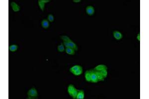 Immunofluorescent analysis of HepG2 cells using ABIN7149764 at dilution of 1:100 and Alexa Fluor 488-congugated AffiniPure Goat Anti-Rabbit IgG(H+L) (Desmin Antikörper  (AA 2-86))