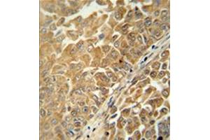 anti-Chromosome 18 Open Reading Frame 25 (C18ORF25) (AA 163-191), (Middle Region) antibody