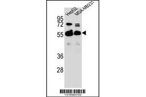 Western blot analysis in HepG2,MDA-MB231 cell line lysates (35ug/lane). (RAP1GDS1 Antikörper  (AA 217-244))