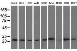 Western blot analysis of extracts (35 µg) from 9 different cell lines by using anti-AK3 monoclonal antibody. (Adenylate Kinase 3 Antikörper)