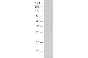 RPLP0 Protein (AA 33-169) (His-IF2DI Tag)