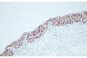 Immunohistochemistry (IHC) image for anti-Antigen Identified By Monoclonal Antibody Ki-67 (MKI67) antibody (ABIN7598807)