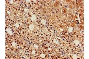 Immunohistochemistry of paraffin-embedded human adrenal gland tissue using ABIN7157120 at dilution of 1:100 (IDH1 Antikörper  (AA 1-240))