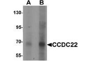 Western blot analysis of CCDC22 in 293 cell lysate with CCDC22 antibody Cat,. (CCDC22 Antikörper  (N-Term))