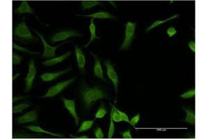 Immunofluorescence (IF) image for anti-Oxidative-Stress Responsive 1 (OXSR1) (AA 351-450) antibody (ABIN564271)